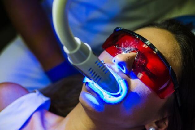 Laser Dental Treatment in Hyderabad