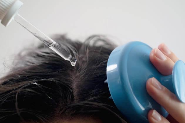 Best Scalp treatment in Hyderabad