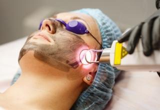 Laser Hair, Tattoo & Scar Removal in Hyderabad