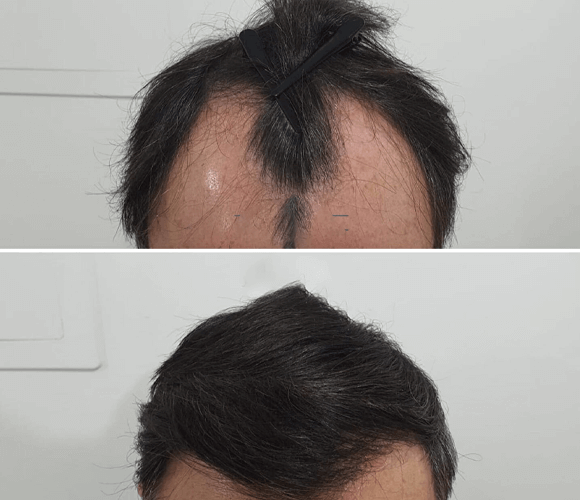 Best Dental Clinic in Hyderabad