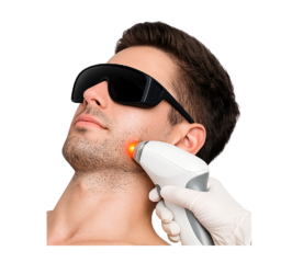laser hair reduction image.